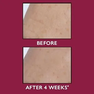 Peter Thomas Roth | Even Smoother Glycolic Retinol Resurfacing Serum | Glycolic Acid Serum with Retinol for Uneven Texture and Tone  1 fl. oz. - Peter Thomas Roth, Even Smoother Glycolic Retinol Resurfacing Serum, before and after B&A