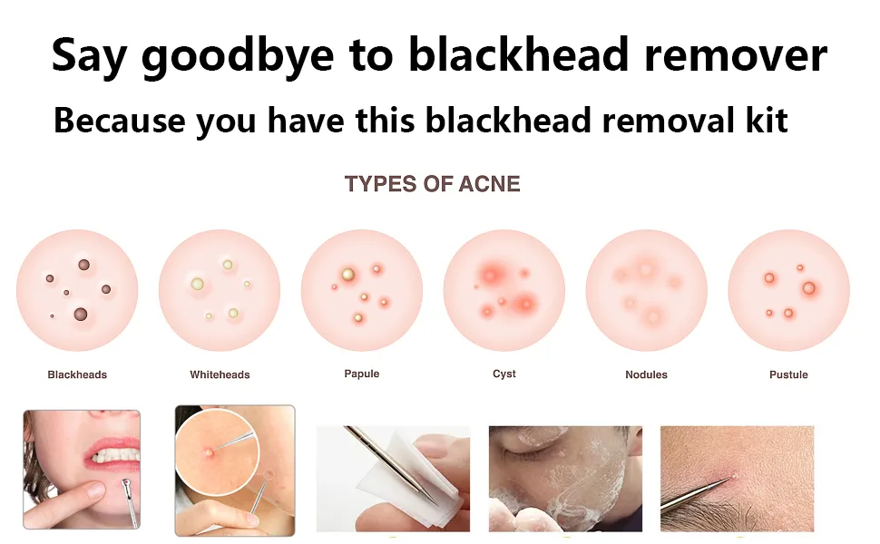 Blackhead Remover 16pcs Kit with Portable Box - Blackhead Remover