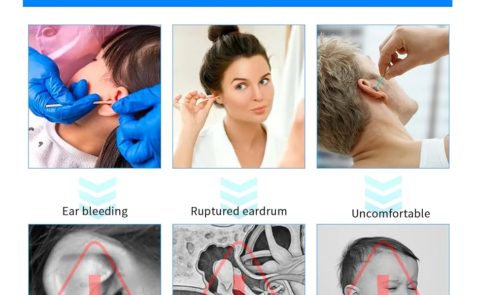 Ear Wax Removal Tool Camera  Ear Wax Removal Tool with 1080P  8 Pcs Ear Wax Removal Set  Wireless Ear Cleaning Compatible with iPhone  iPad  Android - ear wax