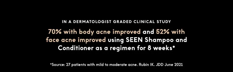 SEEN Conditioner - Non-Comedogenic & Sulfate-Free Hair Conditioner- Dermatologist-Developed -Safe for Sensitive  Eczema & Acne Prone Skin Scented Regular - SEEN Acne Study