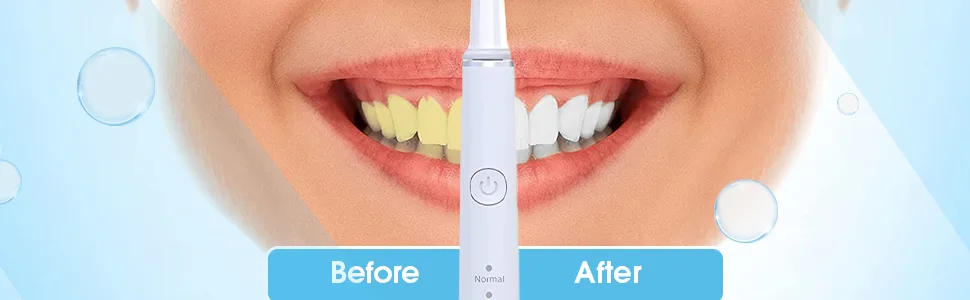 Pursonic Whitening USB Rechargeable Sonic Toothbrush-12 Brush Heads!- 38 000 Brush Strokes Per Minute-3 Brushing Modes with 2 Minute Auto Timer (White) - product information 4
