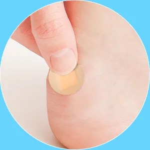 Adhesive Spot Bandage Flex Fabric Adhesive Bandages 0.87 Inch Diameter Round Bandage with Non Stick Pad (400) - product information 8