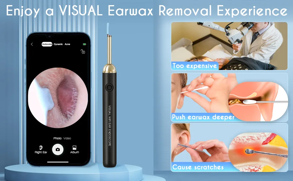 Upmore Ear Wax Removal Tool  Ear Cleaner with Camera 500W Pixel HD  Ear Camera Otoscope with 6 LED Light  Ear Wax Removal kit for iOS Android. White - ear wax removal tool