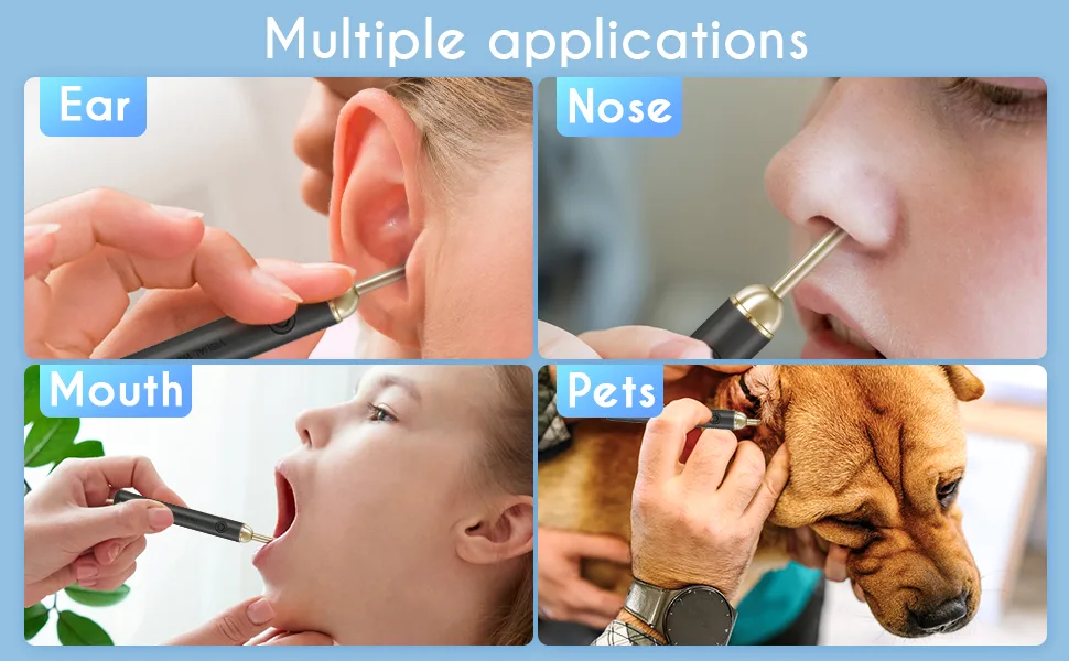Upmore Ear Wax Removal Tool  Ear Cleaner with Camera 500W Pixel HD  Ear Camera Otoscope with 6 LED Light  Ear Wax Removal kit for iOS Android. White - earwax removal