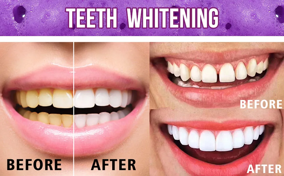 2PCS Whitening Toothpaste Purple Toothpaste for Teeth Whitening Color Corrector Toothpaste Toothpaste Whitening Teeth Whitening Toothpaste Remove Stains Improves Teeth Brightness and Reduce Yellowing - product information 3