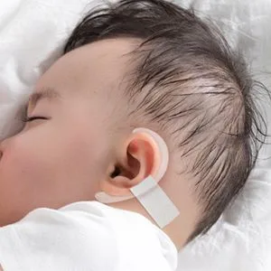 Auricle Correction Patch  Baby Ear Aesthetic Corrector Infant Silicone Baby Auricle Valgus Correction Patch  Baby Ear Corrector for Babies with A Pair Ear Supports  Children Ear Correction - product information 17