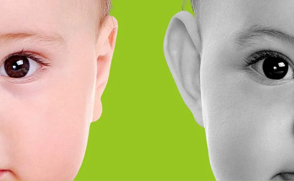 Auricle Correction Patch  Baby Ear Aesthetic Corrector Infant Silicone Baby Auricle Valgus Correction Patch  Baby Ear Corrector for Babies with A Pair Ear Supports  Children Ear Correction - product information 22