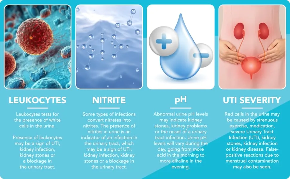 URS 9-in-1 Urine Test Strips 9 Parameters Testing UTI  Protein/Leukocytes/Nitrite/pH/Blo  100 CT - Parameter specification