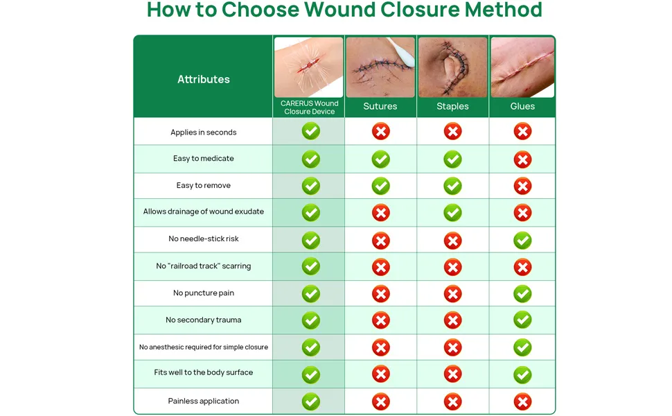 5pcs Suture Free Wound Closure Strips  Zip Stitch Sutures  Butterfly Bandaids  Emergency Wound Closure Device  Laceration Repair Without Stitches  Wound Care for First Aid Kits - Cound closure