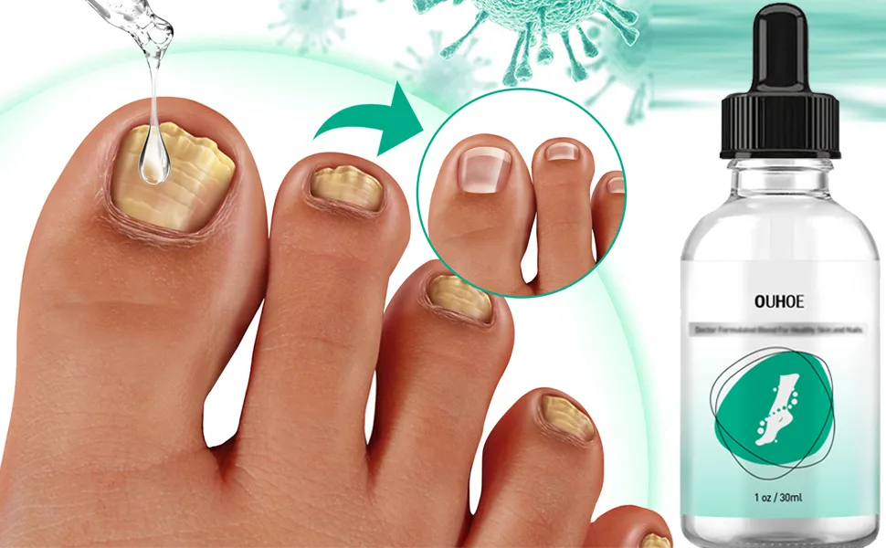 Kerassentials Toenail Treatment Oil Kerasentials for Toenail Kerasentials Nail Treatment May Support Strong Healthy Natural Nails 3PCS - OIL2