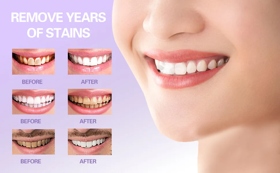 Whitening Toothpaste Purple Toothpaste for Teeth Whitening Colour Corrector Toothpaste Toothpaste Whitening V34 Toothpaste Remove Stains Improves Teeth Brightness and Reduce Yellowing - product information 5