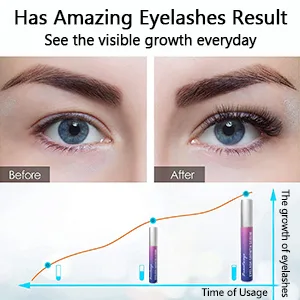 Eyelash Growth Serum  Natural Eyelash Enhancer  Brow & Lash Enhancing Formula & Rapid Brow Growing Treatment for Longer  Thicker And Strong Lashes  - Eyelash Growth Serum