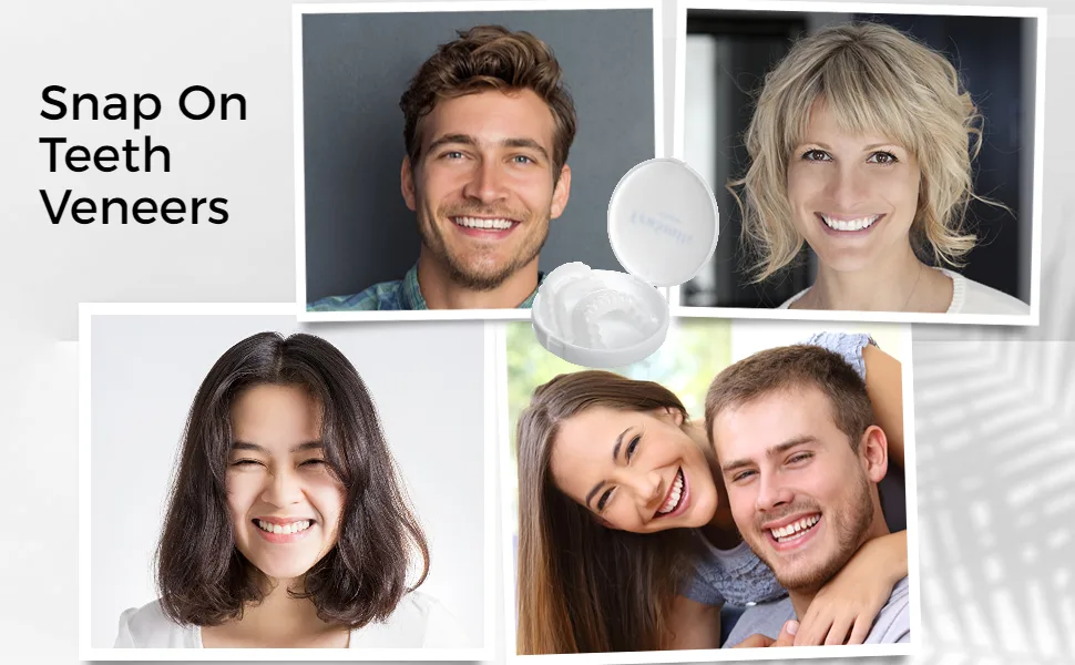 Anjetan Teeth Whitening Trays - Thin Moldable Mouth Trays Form Perfectly to Each Tooth - Teeth Veneers