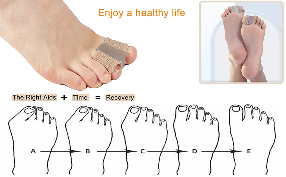 Golbylicc Bunion Toe Separators for Overlapping Toes Women Men  Gel Toe Spacers Bunion Corrector with 2 Loops for feet (4PC) - Bunion Toe Separators