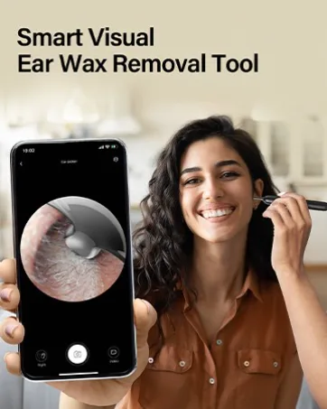 BEBIRD Ear Cleaner Tips Without Ring  Original Replacement Ear Spoons for Ear Wax Removal C3/C3 Pro X17 Pro M9 Pro A2 B2 Pro K10  Accessories Set Only for Metal Ring White - Ear Cleaner