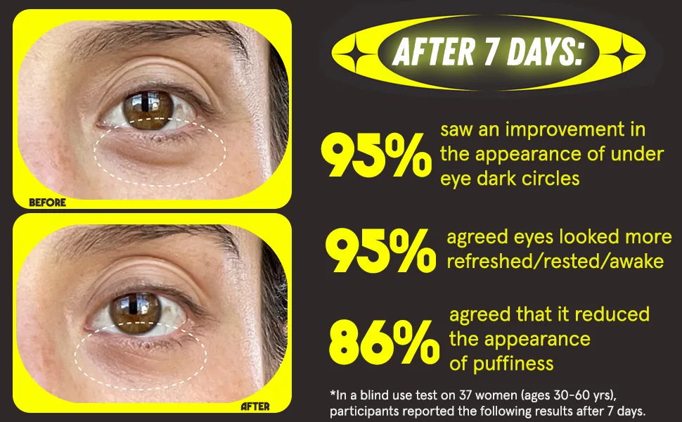HERBIVORE Botanicals Super Nova Eye Cream - Powered by 5% THD Vitamin C + Caffeine to Reduce Dark Circles  Puffiness and Brightens Eyes - RESULTS