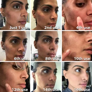 Dark Spot Fast + Natural Serum - Treatment for Melasma  Hyperpigmentation  and Discoloration Correction - cleanser