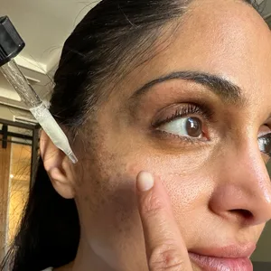 Dark Spot Fast + Natural Serum - Treatment for Melasma  Hyperpigmentation  and Discoloration Correction - dark spot serum