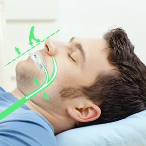 Anti-Snoring Mouthpiece Solution  Comfort Size (1)  Snoring Solution for a Better Night s Sleep  Clear White-222 - product information 3