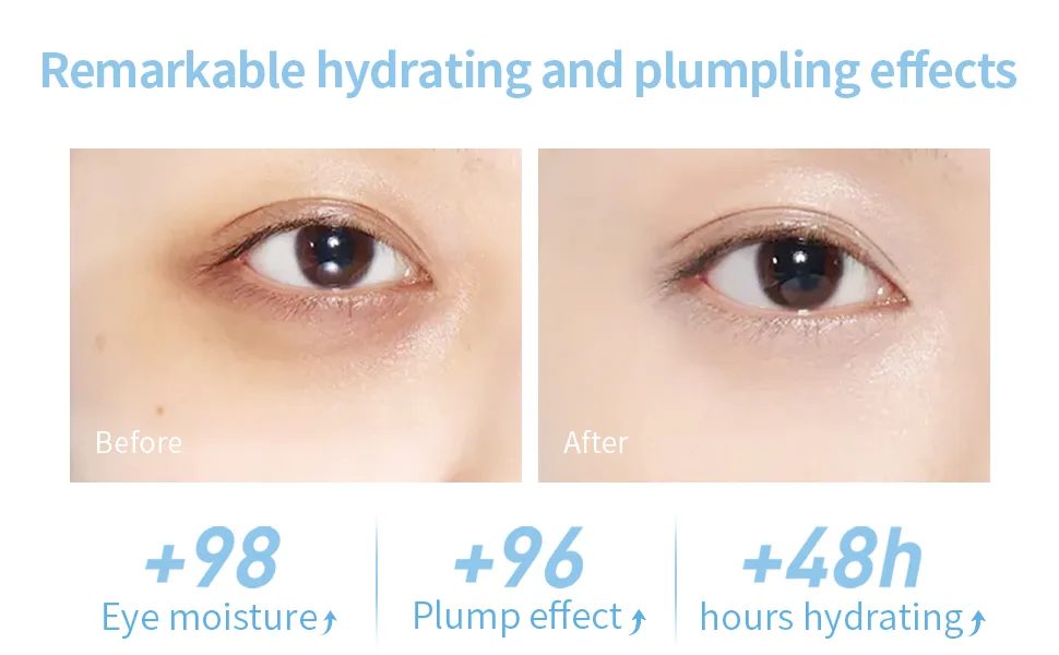 4D Hydrating Under Eye Serum  LANBENA SPComplex Hyaluronic Acid Eye Cream  Moisturizing & Replumping  Reduces Fine Lines & Crow's Feet 2 Bionic Peptides  Algae Extract  Plant Formula for Dark Circles - remarkable