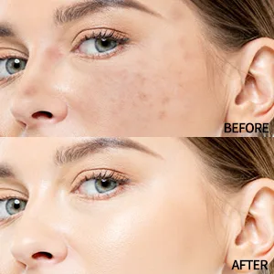 Mushroom Head Air Cushion CC Cream Face Foundation Concealer BB Cream  New Upgrate Moisturizing Long Lasting Bright Cushion Foundation Base Primer Full coverage for flawless makeup(104  Buff beige) - Foundation Base Primer