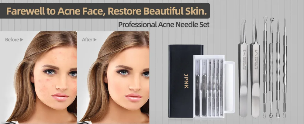 JPNK New Black Pimple Acne Blemish Removal Tools  Blackhead Comedones Extractor Acne Removal Kit Set with Mirror Tweezer - product information 1