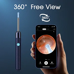 Ear Wax Removal - Earwax Remover Tool with 8 Pcs Ear Set - Ear Cleaner with Camera - Earwax Removal Kit with Light - Ear Camera with 6 Ear Spoon - Ear Cleaner for iOS & Android (Blue) - Ear Wax Removal