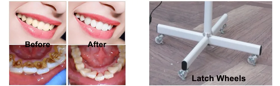 Mobile Dental Teeth Whitening Light Kit Professional Machine 36w 10 Led Teeth Whitening Lamp Stand  Portable Blue Light Cold Light Bleaching Accelerator Teeth Whitener Floor Standing Type-US Ship - Effects