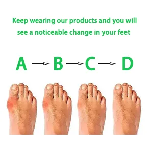 WUTAIN Toe Separator- Relieve Foot Pain Bunion Corrector  Silicone Material Toe Straightener  Correction Toe Spreader  for Overlapping Toes  Hammer Toes  Toe Pad (Large) - toe corrector step