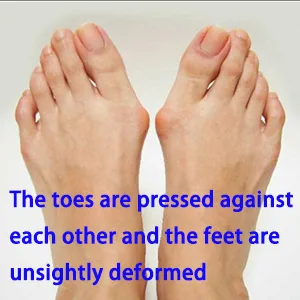 WUTAIN Toe Separator- Relieve Foot Pain Bunion Corrector  Silicone Material Toe Straightener  Correction Toe Spreader  for Overlapping Toes  Hammer Toes  Toe Pad (Large) - toe separator for bunions