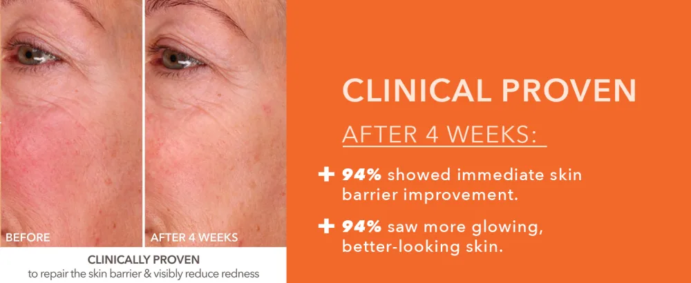 Dr Dennis Gross DermInfusions Fill + Repair Serum: Immediately Fills Lines  Plumps & Repairs  1 oz - CLINICAL RESULTS