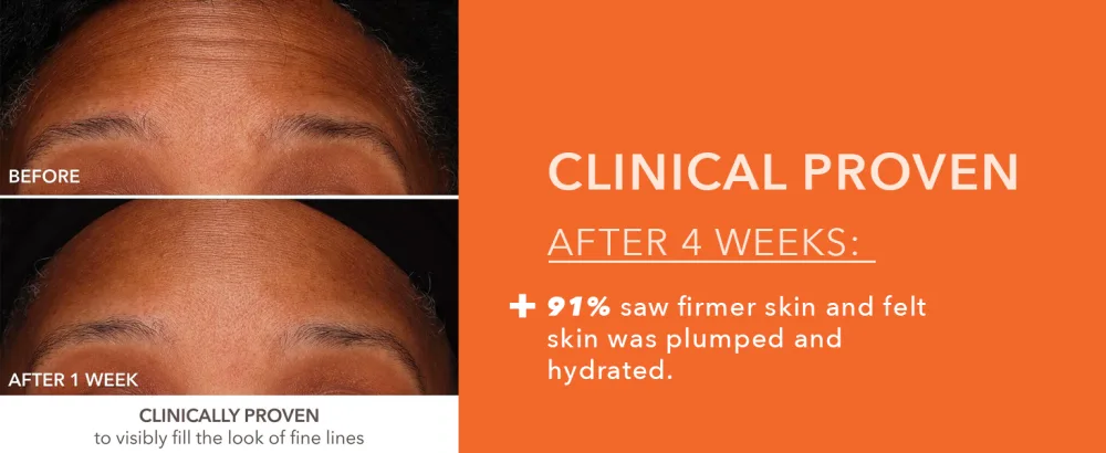 Dr Dennis Gross DermInfusions Fill + Repair Serum: Immediately Fills Lines  Plumps & Repairs  1 oz - RESULTS