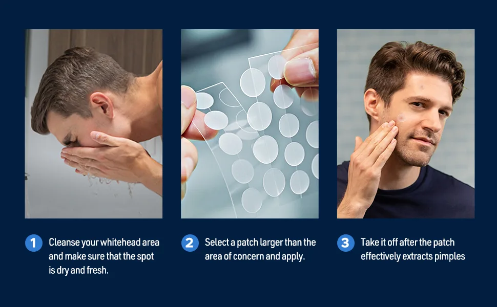 LitBear Acne Patch Pimple Patch  2 Sizes 138 Patches Professional Acne Absorbing Cover Patch for Men  Hydrocolloid Invisible Acne Patches For Face Zit Patch Acne Dots Tea Tree  Calendula Oil - acne patches
