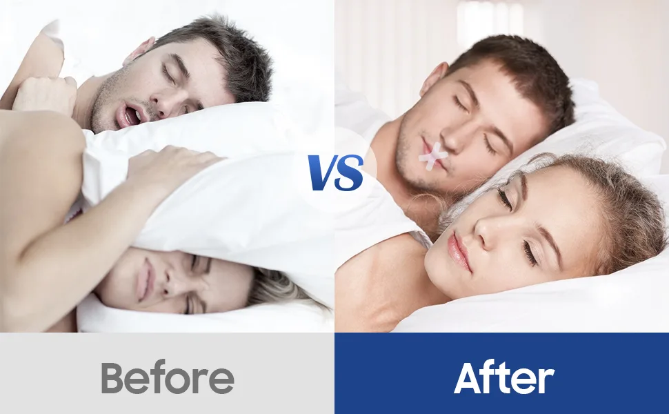 Advanced Gentle Sleep Strips Mouth Tape for Sleeping  Improve Breathing Mode Stop Snoring Mouth Tape for Nose Breathing & Better Sleep (120 PCS) - product information 2