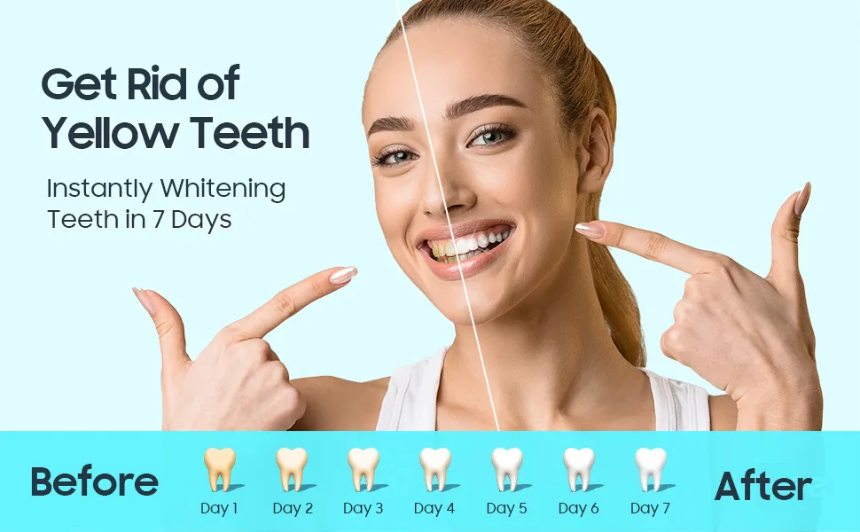 Teeth Whitening Strip Teeth Whitener - Professional Effects Enamel Safe White Strips for Teeth Whitening  5D Whitening Strips for Teeth Sensitive Dental Teeth Whitening Strips Kit (28 PCS) - product information 3