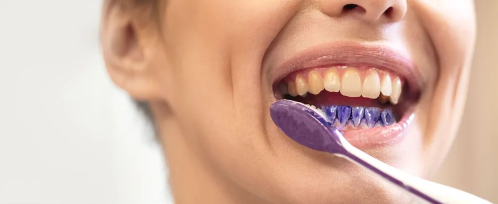 Viebeauti Purple Toothpaste for Teeth Whitening  Purple Colour Corrector  Teeth Whitening Toothpaste  Color Wheel Toothpaste  Dental Color Corrector  Teeth Whitener (1fl oz/30 ml) - Purple Toothpaste for Teeth Whitening