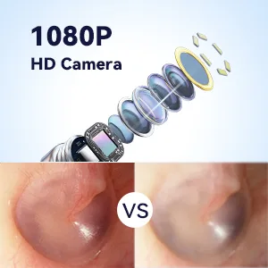 Ear Wax Removal - R1 Earwax Remover Tool with 1080P HD Camera 6 LED Lights - Wireless Ear Cleaner Built-in WiFi - Earwax Removal Kit Compatible with iPhone Android - 1080P camera