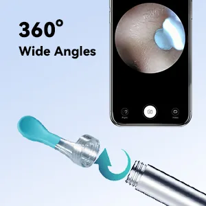 Ear Wax Removal - R1 Earwax Remover Tool with 1080P HD Camera 6 LED Lights - Wireless Ear Cleaner Built-in WiFi - Earwax Removal Kit Compatible with iPhone Android - wide angles