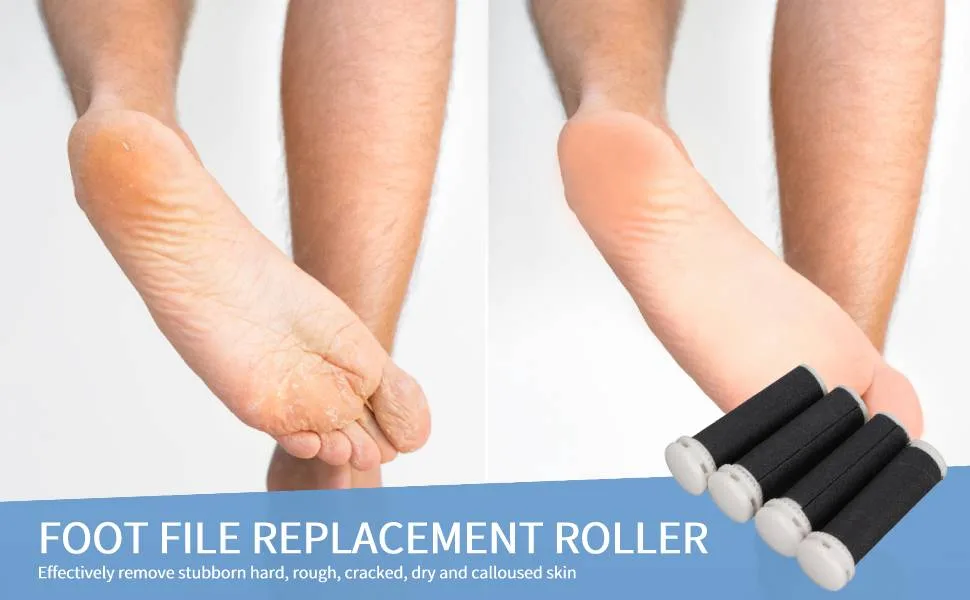 Foot File Replacement Roller  4pcs Micro Pedi Replacement Rollers Electric Pedicure Roller Head Refill Roller Head Replacement Foot File Grinding Tool Replacement Head - electric pedicure head