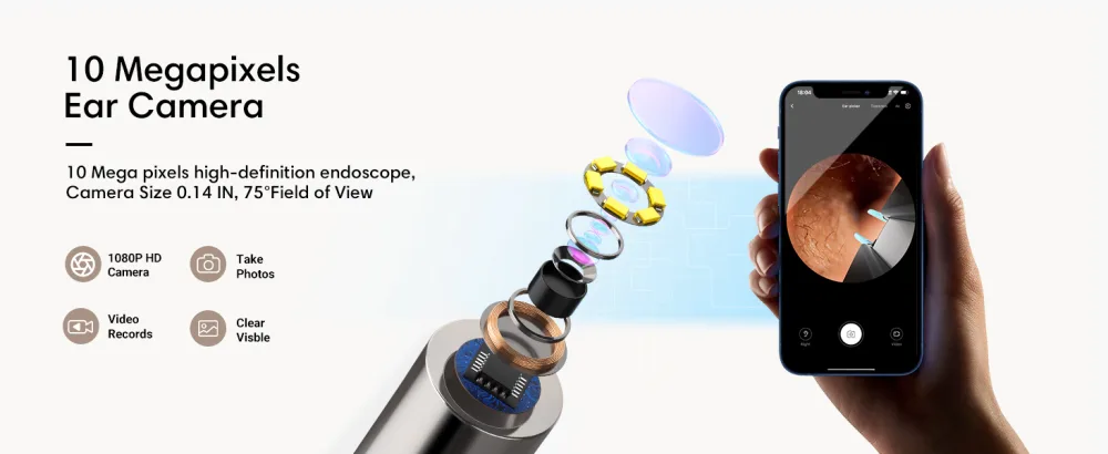 Ear Camera Ear Wax Removal Tool Bebird Ear Cleaner Tweezers 10 Megapixels Ear Camera Gimbaled Gyroscope  6 Earwax Removal Kit 12 Ear Spoon Base Storage Ear Cleaning Kit for iPhone  Android Blue - 10 Mega pixels