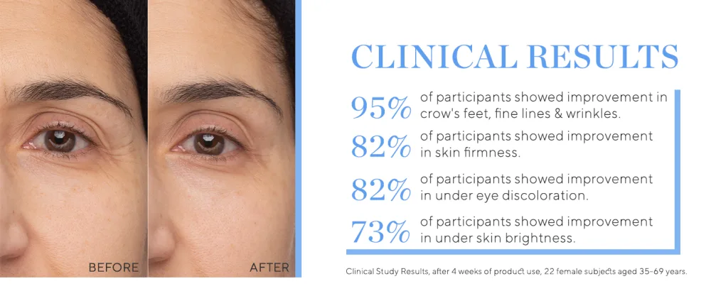 HydroPeptide Retinol Eye Renewal Lifting & Firming Eye Balm with 0.65% Universal Tri-Retinol Complex  0.5 Ounce - results