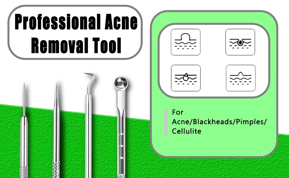 Blackhead Remover Tool  Stainless Steel Pimple Popper Tool Kit  Blackhead Extractor Tool for Face  5-in-1 Blackhead Remover Tool *4 Tweezers *1-0414042 - product information 3