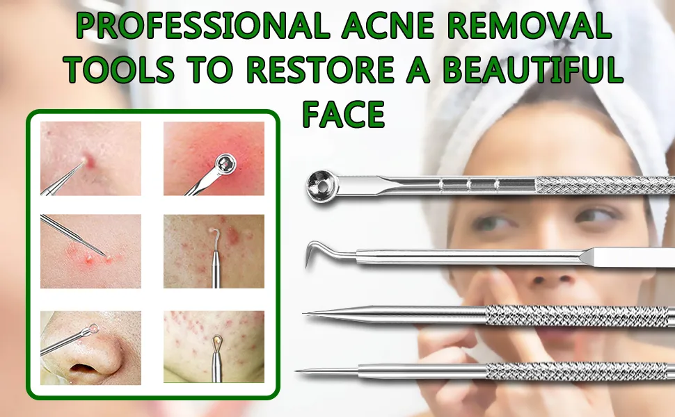 Blackhead Remover Tool  Stainless Steel Pimple Popper Tool Kit  Blackhead Extractor Tool for Face  5-in-1 Blackhead Remover Tool *4 Tweezers *1-0414042 - product information 4
