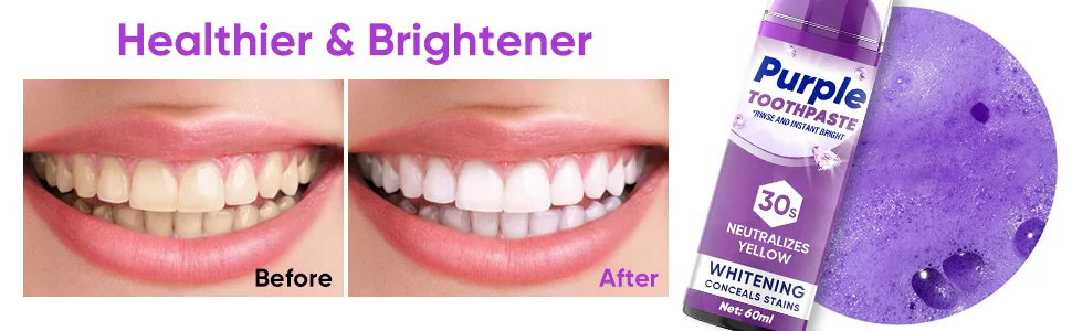Purple Toothpaste for Teeth Whitening - Tooth Stain Removal Purple Toothpaste Teeth Colour Correcting Teeth Whitener - teeth whitening purple toothpaste