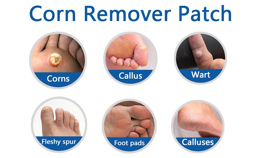 Gelanori Corn Removers for Feet and Toe  Foot Care corn pads (10 pcs) - toe corn remover