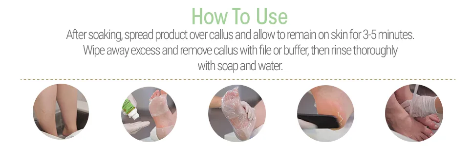 ProLinc Fast Acting Callus Eliminator  4 Fl Oz (Pack of 1) - ProLinc Callus Eliminator 4 Oz