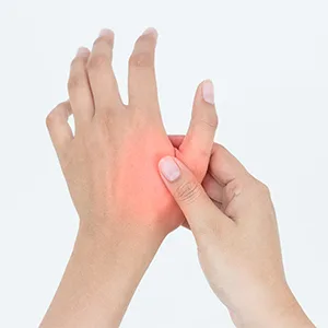 MARS WELLNESS CMC Joint Thumb Arthritis Brace - Restriction Thumb Support Brace Stabilizing Splint for Osteoarthritis and arthritis thumb splint - Medium - Right Hand Medium (Pack of 1) Right Hand - EBC 2_1