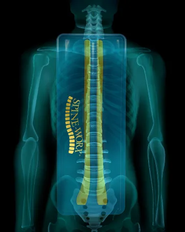 Spine-Worx Back Realignment Device  Thoracic and Lumbar Relief Back Stretcher  Spinal Alignment  Back Stretching Device  Chiropractic Alignment  Back Stretching Device  Back Support Product - Thermotex, Back alignment tool