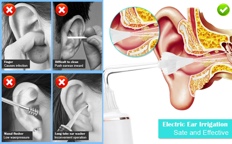 Grathia Ear Wax Removal 360 rotatable Electric Ear Cleaning Kit Ear Irrigation Kit with 3 Pressure Modes for Ear Wax Buildup Complete Ear Cleaning Irrigation Kit for Adults and Kids - Ear Wax Removal