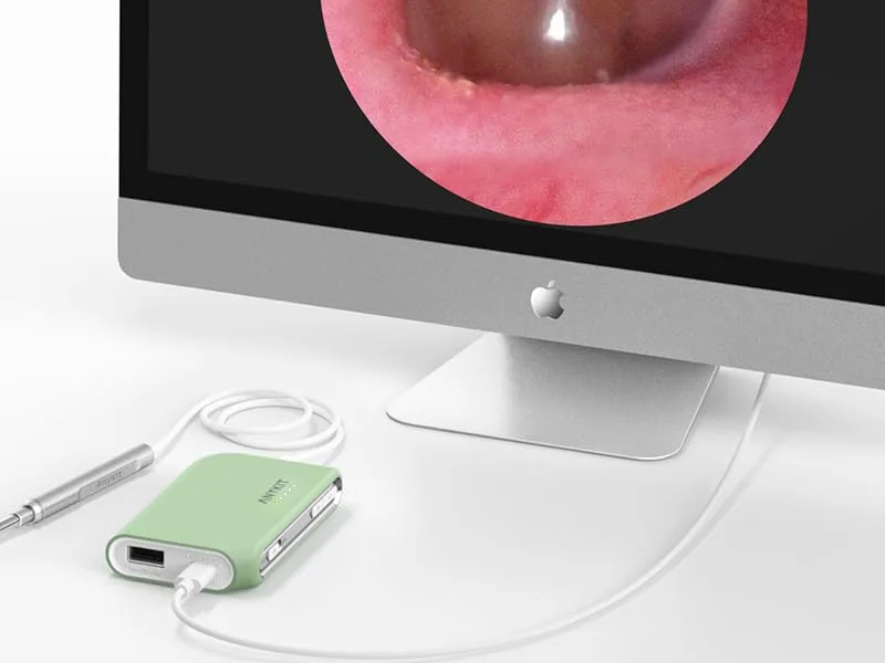 Anykit USB Otoscope for iPhone Android & PC 3.9mm Ultra Clear Ear Camera with Adjustable LED Lights 720PHD Ear Scope with Ear Wax Removal Tool for Kids Adults & Pets - ear camera for MAC